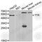 Transthyretin antibody, A3186, ABclonal Technology, Western Blot image 