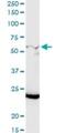 Polypeptide N-acetylgalactosaminyltransferase 12 antibody, H00079695-D01P, Novus Biologicals, Western Blot image 