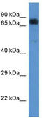 Acyl-CoA Dehydrogenase Family Member 9 antibody, TA343058, Origene, Western Blot image 