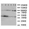 Nuclear Factor Kappa B Subunit 1 antibody, LS-C313240, Lifespan Biosciences, Western Blot image 