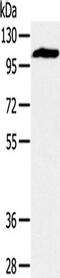 Glycogen Phosphorylase, Muscle Associated antibody, TA350316, Origene, Western Blot image 