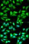 Glutathione Synthetase antibody, LS-B14854, Lifespan Biosciences, Immunofluorescence image 