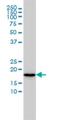 N(Alpha)-Acetyltransferase 20, NatB Catalytic Subunit antibody, H00051126-M01, Novus Biologicals, Western Blot image 