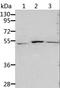 Aldehyde Dehydrogenase 3 Family Member B1 antibody, LS-C404482, Lifespan Biosciences, Western Blot image 