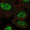 Msh Homeobox 1 antibody, NBP2-57021, Novus Biologicals, Immunofluorescence image 