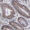 Zinc Finger Protein 550 antibody, NBP1-86158, Novus Biologicals, Immunohistochemistry paraffin image 