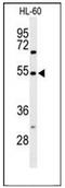 Gastrin Releasing Peptide Receptor antibody, AP51959PU-N, Origene, Western Blot image 