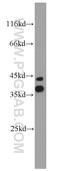 Calcium Homeostasis Modulator 1 antibody, 22042-1-AP, Proteintech Group, Western Blot image 