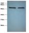 FUS RNA Binding Protein antibody, LS-C212095, Lifespan Biosciences, Western Blot image 