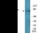 Microtubule Associated Protein Tau antibody, EKC2534, Boster Biological Technology, Western Blot image 