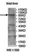 Ubiquitin Protein Ligase E3A antibody, orb78161, Biorbyt, Western Blot image 