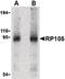 CD180 Molecule antibody, PA5-20252, Invitrogen Antibodies, Western Blot image 