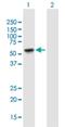 Tubulointerstitial Nephritis Antigen Like 1 antibody, H00064129-B02P, Novus Biologicals, Western Blot image 