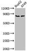 Complement Factor B antibody, LS-C669925, Lifespan Biosciences, Western Blot image 