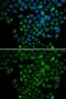 Fatty Acid Binding Protein 4 antibody, GTX54016, GeneTex, Immunofluorescence image 