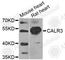 Calreticulin-3 antibody, A5133, ABclonal Technology, Western Blot image 