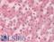 Low Density Lipoprotein Receptor antibody, LS-C142546, Lifespan Biosciences, Immunohistochemistry paraffin image 