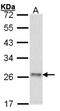 ATP Synthase Peripheral Stalk Subunit OSCP antibody, NBP1-31646, Novus Biologicals, Western Blot image 