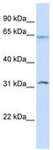 Methyltransferase-like protein 16 antibody, TA342473, Origene, Western Blot image 