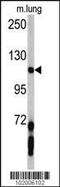 Platelet Derived Growth Factor Receptor Alpha antibody, 63-116, ProSci, Western Blot image 