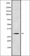 Testis Specific Serine Kinase 6 antibody, orb336327, Biorbyt, Western Blot image 
