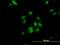 Peptidylprolyl Isomerase E antibody, H00010450-M02, Novus Biologicals, Immunocytochemistry image 