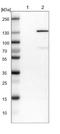 Erb-B2 Receptor Tyrosine Kinase 4 antibody, NBP1-90371, Novus Biologicals, Western Blot image 