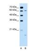 Cytochrome P450 Family 4 Subfamily A Member 22 antibody, NBP1-80495, Novus Biologicals, Western Blot image 