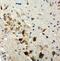 TSC Complex Subunit 1 antibody, PA5-80193, Invitrogen Antibodies, Immunohistochemistry frozen image 