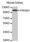 Prominin 1 antibody, abx000736, Abbexa, Western Blot image 