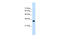 Ring Finger Protein 121 antibody, 29-850, ProSci, Western Blot image 