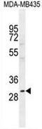 C-type lectin domain family 10 member A antibody, AP50955PU-N, Origene, Western Blot image 