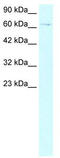 ZBTB20 antibody, TA329421, Origene, Western Blot image 