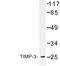 TIMP Metallopeptidase Inhibitor 3 antibody, LS-C176998, Lifespan Biosciences, Western Blot image 