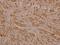 ERBB2 antibody, A00010Y1248-1, Boster Biological Technology, Immunohistochemistry frozen image 