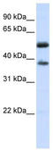 Leucine Rich Repeat Containing 24 antibody, TA336059, Origene, Western Blot image 