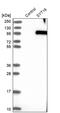 Synaptotagmin 16 antibody, PA5-52072, Invitrogen Antibodies, Western Blot image 