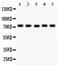 Polycomb protein EED antibody, PB9581, Boster Biological Technology, Western Blot image 