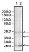 Insulin Like Growth Factor Binding Protein 2 antibody, MA1-90577, Invitrogen Antibodies, Western Blot image 