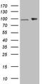 Importin subunit beta-1 antibody, TA811700, Origene, Western Blot image 