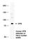 ERCC Excision Repair 3, TFIIH Core Complex Helicase Subunit antibody, PA1-23344, Invitrogen Antibodies, Western Blot image 