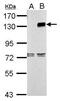 Toll Like Receptor 9 antibody, GTX111490, GeneTex, Western Blot image 