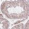 Transmembrane Protein 88 antibody, NBP2-13457, Novus Biologicals, Immunohistochemistry paraffin image 