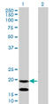 Epithelial Membrane Protein 3 antibody, LS-C133168, Lifespan Biosciences, Western Blot image 