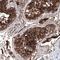 Angiotensin I Converting Enzyme 2 antibody, NBP2-59036, Novus Biologicals, Immunohistochemistry paraffin image 