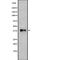 P2Y Receptor Family Member 10 antibody, PA5-67746, Invitrogen Antibodies, Western Blot image 