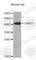 G Protein Subunit Alpha Transducin 1 antibody, A6496, ABclonal Technology, Western Blot image 