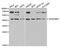 Serpin Family B Member 3 antibody, TA332682, Origene, Western Blot image 