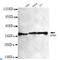 Nucleophosmin 1 antibody, LS-C812868, Lifespan Biosciences, Western Blot image 