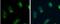 Acyl-CoA Synthetase Long Chain Family Member 4 antibody, NBP2-16400, Novus Biologicals, Immunocytochemistry image 
